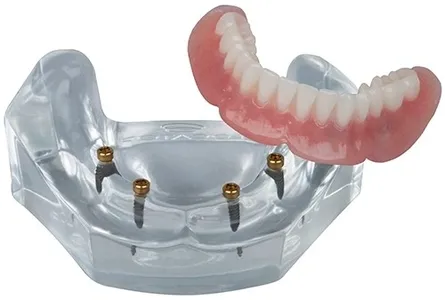Complete Dentures in Calgary: What to Expect During Your Treatment Journey